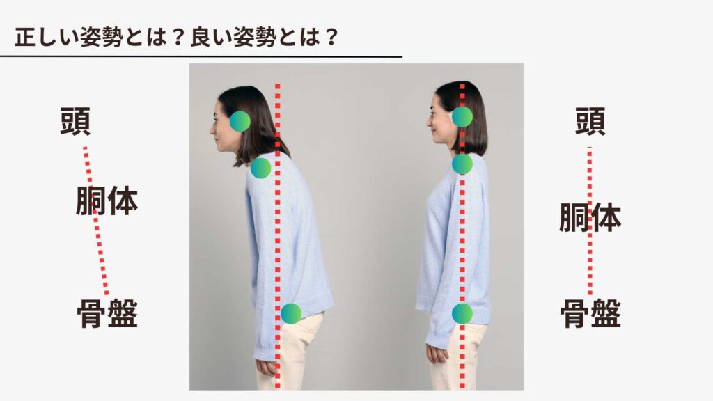 猫背と正しい姿勢を横から比較した画像。頭・胴体・骨盤の位置関係の違いを示し、嚥下と姿勢の関係を説明している