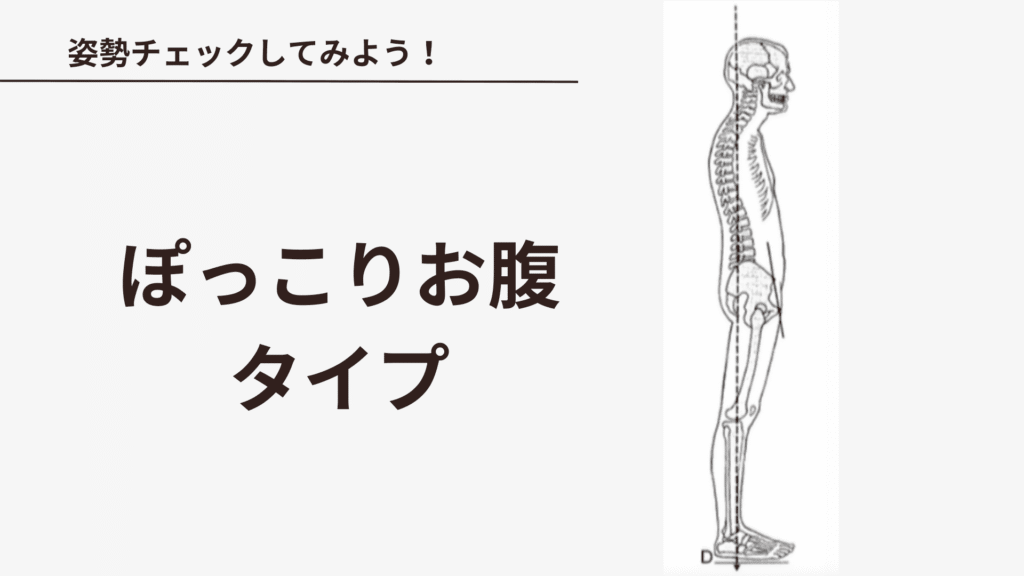 ぽっこりお腹姿勢の例｜姿勢チェックでわかる膝に負担のかかる姿勢【金沢区・京急富岡 整体CORET】