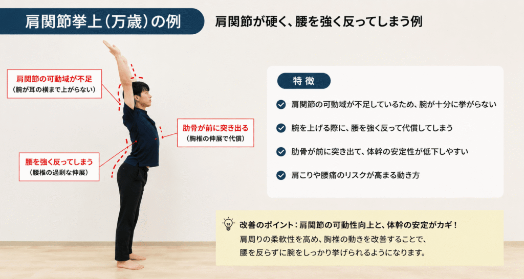 肩関節挙上で肩の可動域不足を腰を反る動きで代償している例